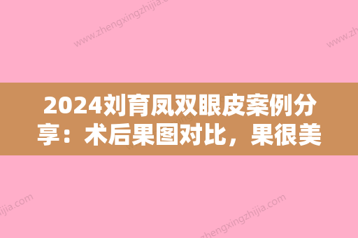 2024刘育凤双眼皮案例分享：术后果图对比，果很美丽