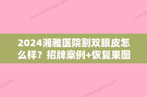 2024湘雅医院割双眼皮怎么样？招牌案例+恢复果图一览