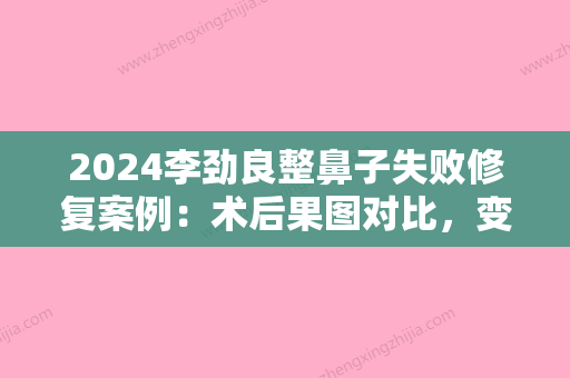 2024李劲良整鼻子失败修复案例：术后果图对比	，变化超大~