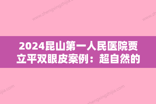 2024昆山第一人民医院贾立平双眼皮案例：超自然的不做作果