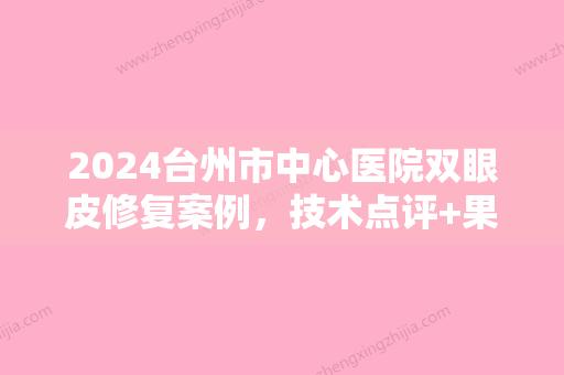 2024台州市中心医院双眼皮修复案例，技术点评+果图对比