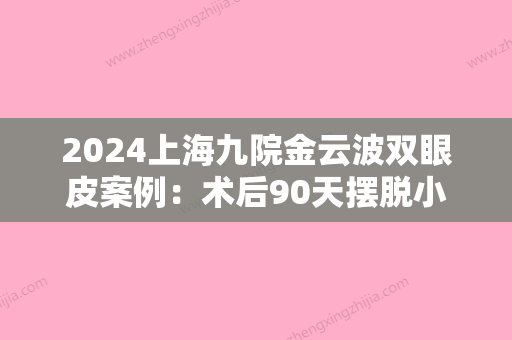 2024上海九院金云波双眼皮案例：术后90天摆脱小眼妹称号