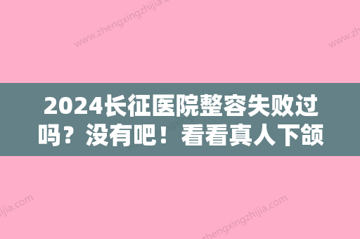 2024长征医院整容失败过吗？没有吧！看看真人下颌角磨骨案例