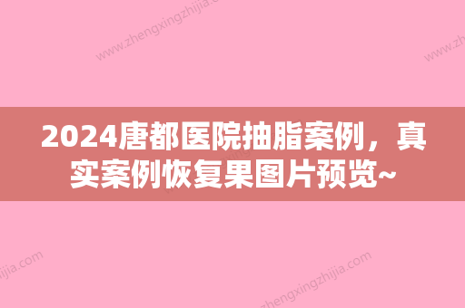 2024唐都医院抽脂案例，真实案例恢复果图片预览~