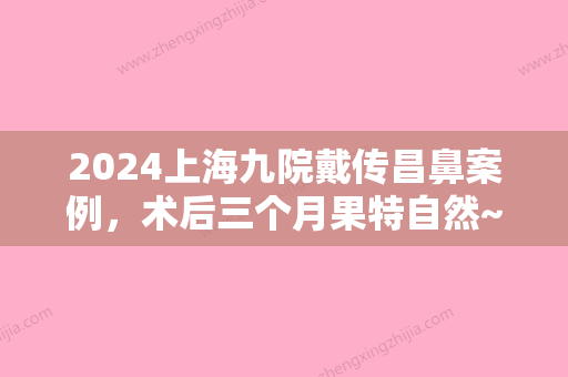 2024上海九院戴传昌鼻案例，术后三个月果特自然~