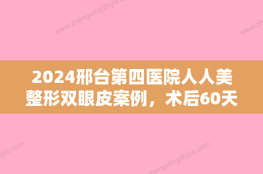 2024邢台第四医院人人美整形双眼皮案例，术后60天超美！