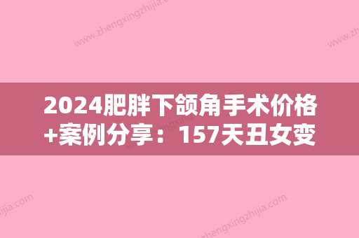 2024肥胖下颌角手术价格+案例分享：157天丑女变身网红美女！