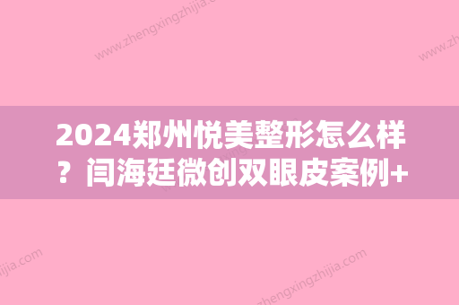 2024郑州悦美整形怎么样？闫海廷微创双眼皮案例+果图一览