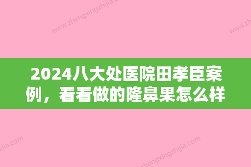 2024八大处医院田孝臣案例，看看做的隆鼻果怎么样？