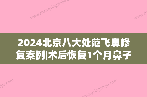 2024北京八大处范飞鼻修复案例|术后恢复1个月鼻子变精致