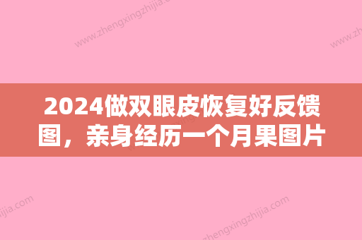 2024做双眼皮恢复好反馈图，亲身经历一个月果图片一览