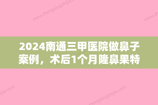 2024南通三甲医院做鼻子案例，术后1个月隆鼻果特别满意