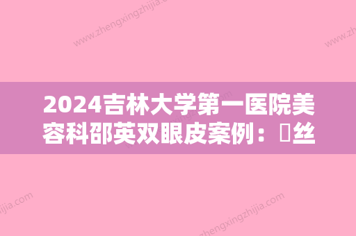 2024吉林大学第一医院美容科邵英双眼皮案例：屌丝逆袭型男！