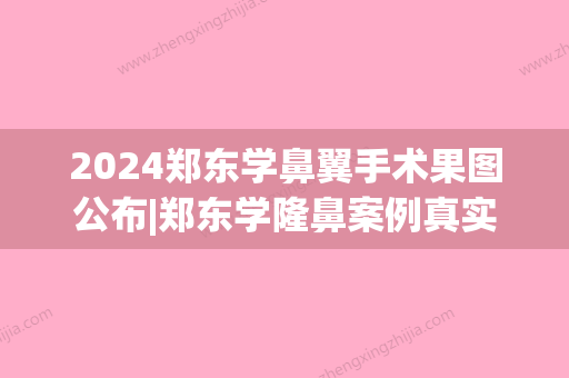 2024郑东学鼻翼手术果图公布|郑东学隆鼻案例真实记录~