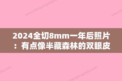 2024全切8mm一年后照片：有点像半藏森林的双眼皮~