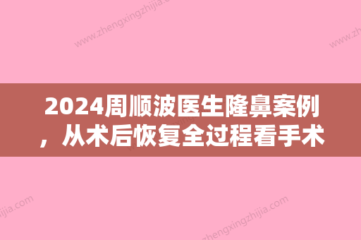 2024周顺波医生隆鼻案例，从术后恢复全过程看手术果~