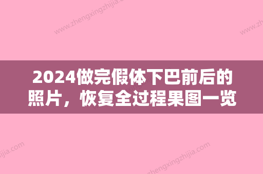 2024做完假体下巴前后的照片，恢复全过程果图一览！