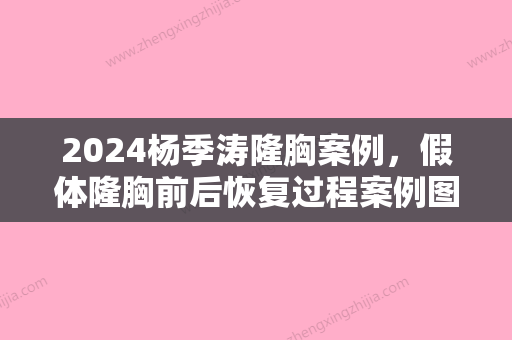 2024杨季涛隆胸案例，假体隆胸前后恢复过程案例图一览！