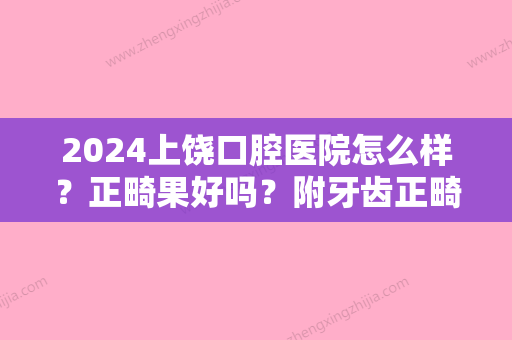 2024上饶口腔医院怎么样？正畸果好吗？附牙齿正畸案例