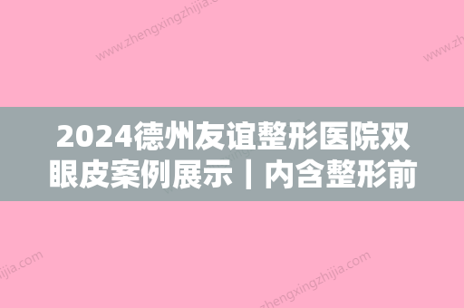 2024德州友谊整形医院双眼皮案例展示｜内含整形前后对比图