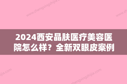 2024西安晶肤医疗美容医院怎么样？全新双眼皮案例一览