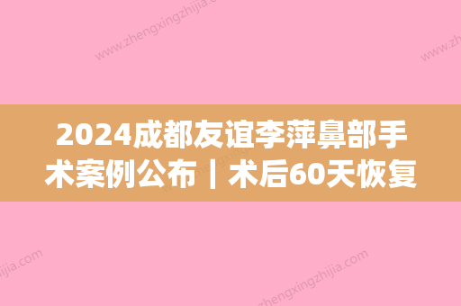 2024成都友谊李萍鼻部手术案例公布｜术后60天恢复果图一览(友谊医院李萍做鼻子)