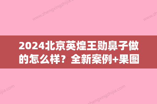 2024北京英煌王勋鼻子做的怎么样？全新案例+果图一览(北京英煌隆鼻王勋)