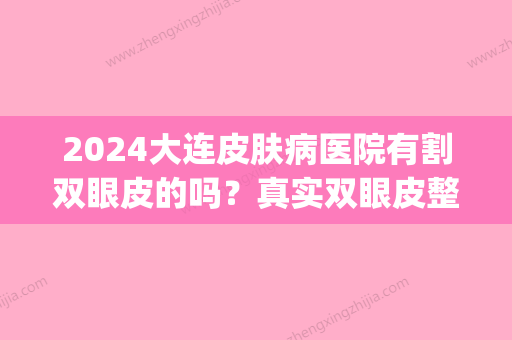 2024大连皮肤病医院有割双眼皮的吗？真实双眼皮整形案例(大连市皮肤病医院整形)