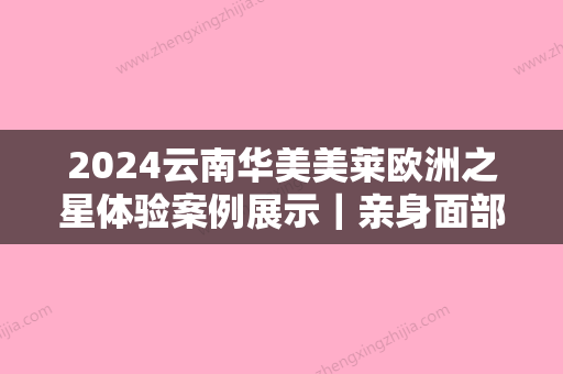 2024云南华美美莱欧洲之星体验案例展示｜亲身面部抗衰全过程分享