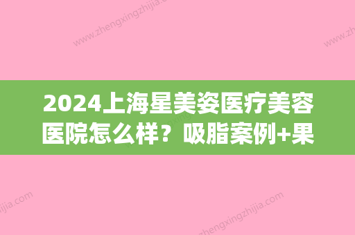 2024上海星美姿医疗美容医院怎么样？吸脂案例+果图分享(南京吸脂整形手术嘉怡美怎么走)