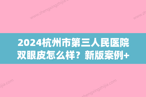 2024杭州市第三人民医院双眼皮怎么样？新版案例+果图公布(杭州市一双眼皮 推荐医生)