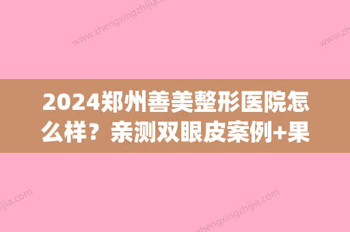 2024郑州善美整形医院怎么样？亲测双眼皮案例+果图分享(善美医疗整形医院郑州)