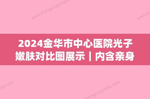 2024金华市中心医院光子嫩肤对比图展示｜内含亲身体验感悟(金华光子嫩肤三甲医院)