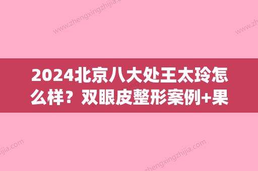 2024北京八大处王太玲怎么样？双眼皮整形案例+果图一览(北京八大处整形双眼皮医生)