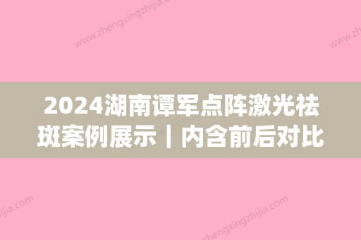 2024湖南谭军点阵激光祛斑案例展示｜内含前后对比图(谭军 点阵激光)