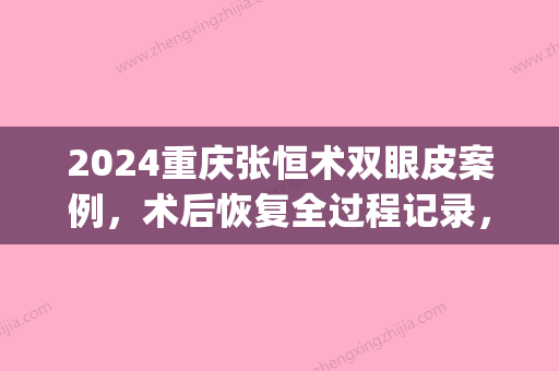 2024重庆张恒术双眼皮案例，术后恢复全过程记录，果特好(割双眼皮恢复案例)