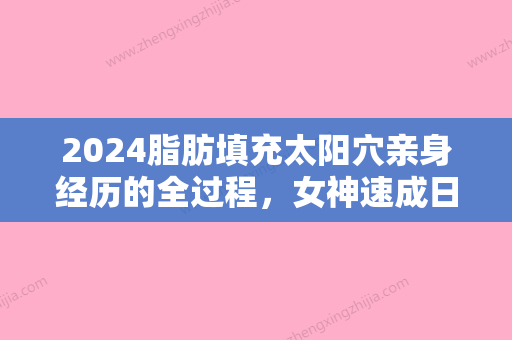 2024脂肪填充太阳穴亲身经历的全过程，女神速成日记！