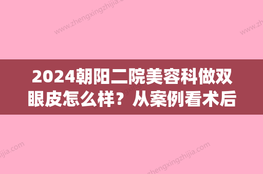 2024朝阳二院美容科做双眼皮怎么样？从案例看术后果！(朝阳二医院双眼皮)