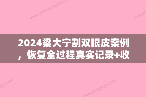 2024梁大宁割双眼皮案例，恢复全过程真实记录+收费标准