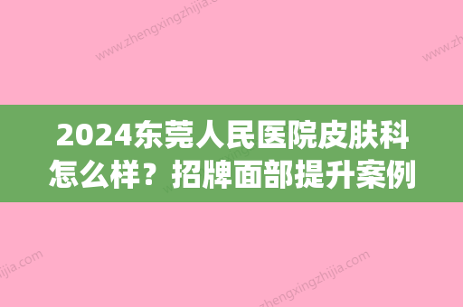 2024东莞人民医院皮肤科怎么样？招牌面部提升案例分享(东莞看脸部皮肤医院)