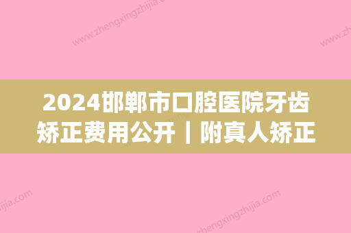 2024邯郸市口腔医院牙齿矫正费用公开｜附真人矫正果图(邯郸市中心医院牙齿矫正)