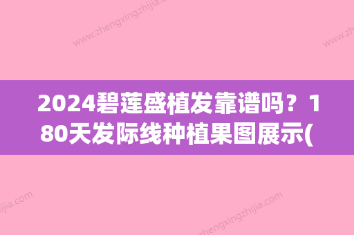 2024碧莲盛植发靠谱吗？180天发际线种植果图展示(碧莲盛植发一般多少钱)