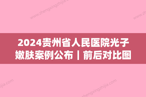 2024贵州省人民医院光子嫩肤案例公布｜前后对比图惊掉下巴(贵州省人民医院 光子嫩肤)