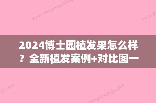 2024博士园植发果怎么样？全新植发案例+对比图一览(博士园植发价格)