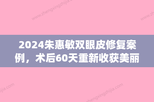 2024朱惠敏双眼皮修复案例，术后60天重新收获美丽与自信(朱惠敏双眼皮怎么样)