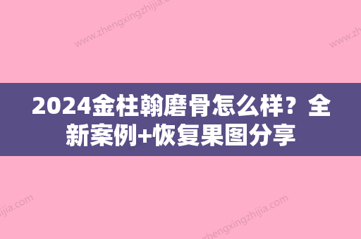 2024金柱翰磨骨怎么样？全新案例+恢复果图分享