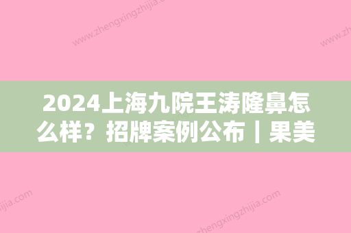 2024上海九院王涛隆鼻怎么样？招牌案例公布｜果美观自然