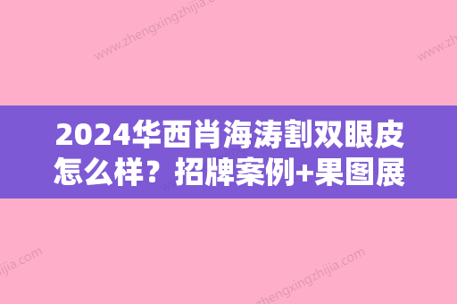 2024华西肖海涛割双眼皮怎么样？招牌案例+果图展示