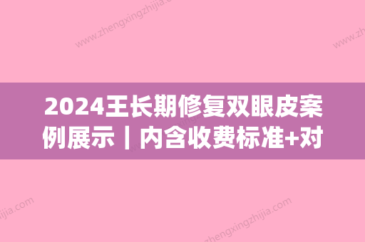 2024王长期修复双眼皮案例展示｜内含收费标准+对比图(王永久修复双眼皮案例)