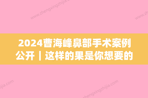 2024曹海峰鼻部手术案例公开｜这样的果是你想要的吗？(南京曹海峰做鼻子案例)